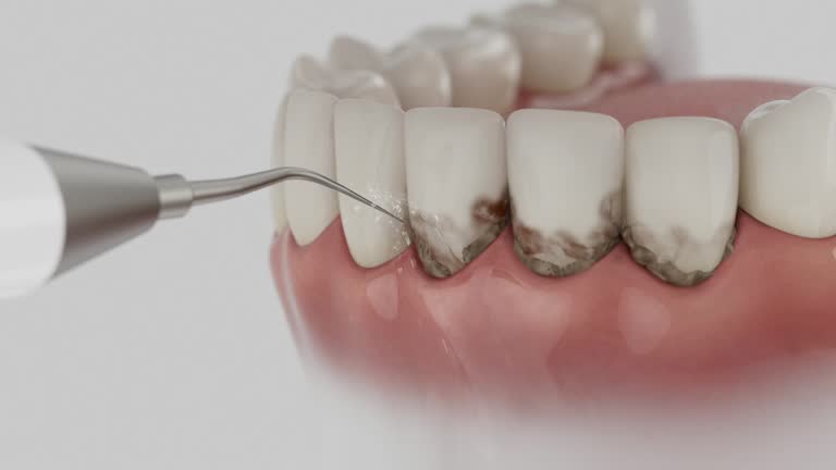 Trusted Dental Implants service in Landmark, AR - Dentist Open Now